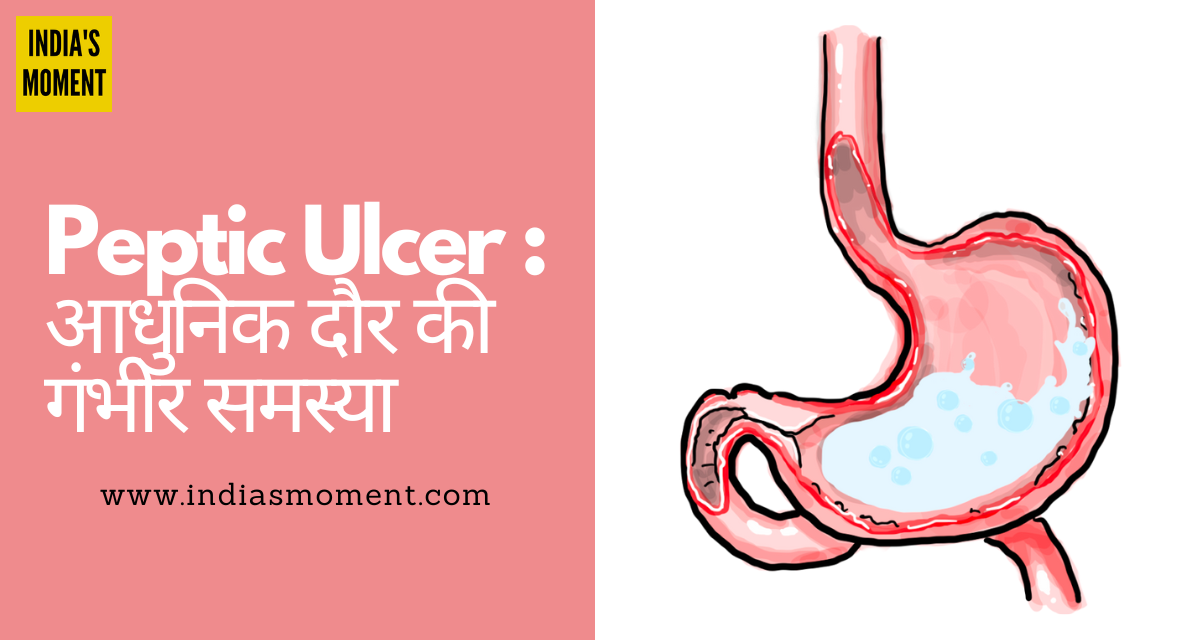 Peptic Ulcer